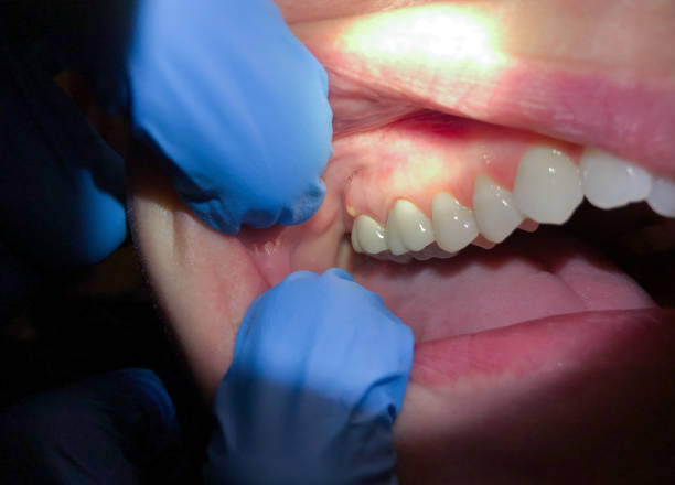 Best Emergency Dental Care for Sports Injuries in Seth Ward, TX