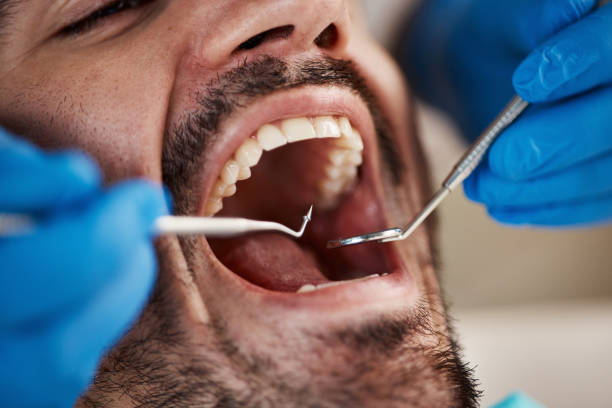 Best Emergency Care for Gum Disease in Seth Ward, TX