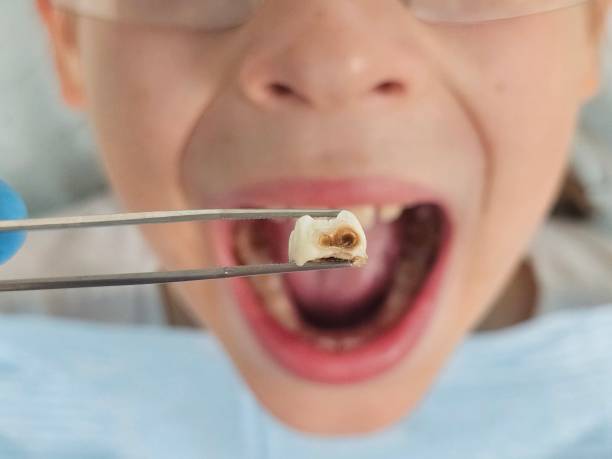 Best Walk-In Emergency Dental Services in Seth Ward, TX