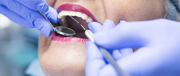Best Emergency Dental Care for Sports Injuries in Seth Ward, TX