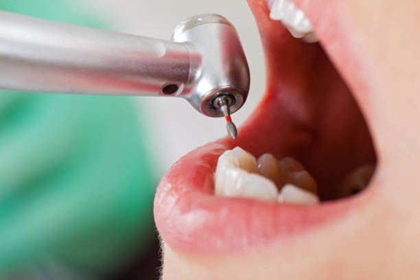 Best Emergency Treatment for Oral Infections in Seth Ward, TX